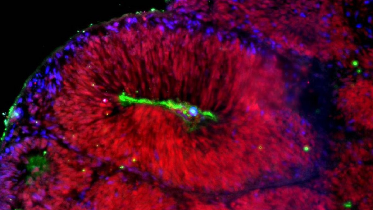 Congratulations to Mikaëlle Bocel <a href="/bocel_m/">Mikaëlle Bocel</a> and Kamal Bouhali, from the enSCORE platform, Epigenetics and Cell Fate lab (@Univ_Paris, <a href="/CNRS/">CNRS 🌍</a>) and <a href="/IJMonod/">Institut Jacques Monod</a>, who won the EDC Prize 🏅, with their photo "Cerebral organoid rosette" 🧠

#bestpicture #organoid