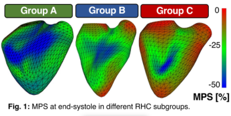 VDelgadoGarcia's tweet image. RV remodeling in HFrEF is associated with unfavourable pulmonary hemodynamic
Have a look at this #ESCAbstract on the #ESCCongress Research Gateway cyim.page.link/nGgB via @escardio