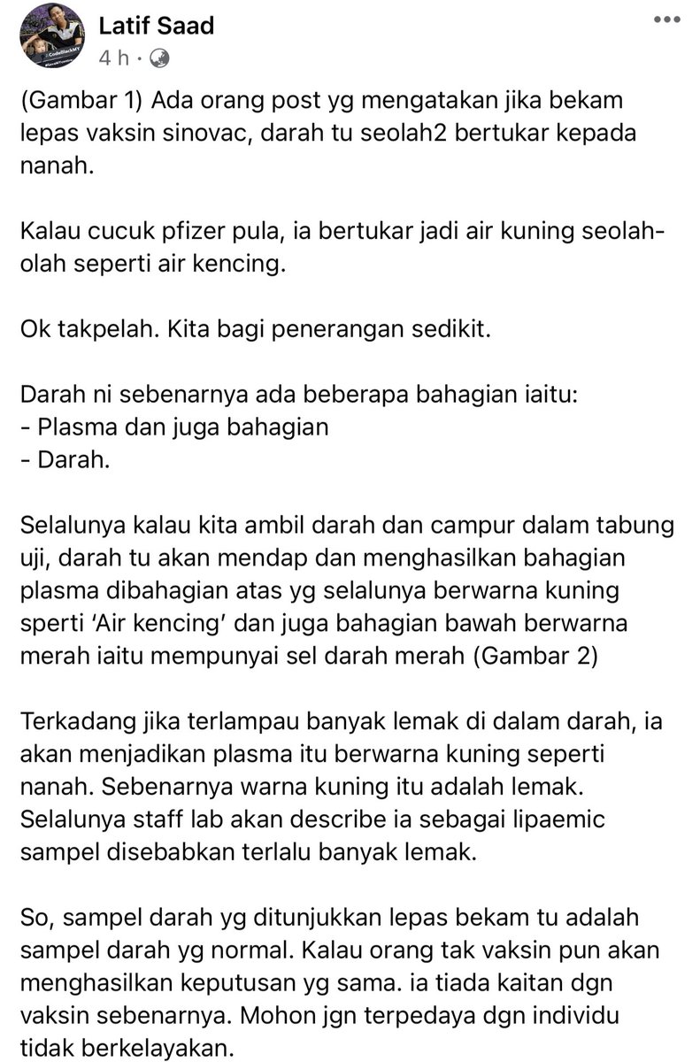 khairul_hafidz's tweet photo. Daripada Dr Latif Saad.

Satu lagi yang kita nampak macam nanah tu namanya lipaemic, iaitu darah atau komponen plasma yang mengandungi banyak lipid (lemak)

Pendek kata, semua normal. Bukan sebab vaksin. https://t.co/lGD224CeMj