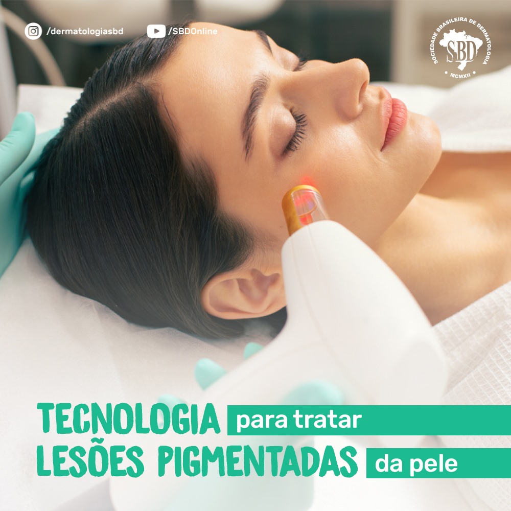 surgical_sbd's tweet photo. Já ouviu falar nos lasers Q-switched? 

Nesse #repost da Sociedade Brasileira de Dermatologia - Estudo publicado na Revista @surgical_sbd (https://t.co/SgH5cBVFg8) concluiu que é importante entender os mecanismos de ação envolvidos nos lasers e suas principais aplicabilidades https://t.co/d4947Ioh6W