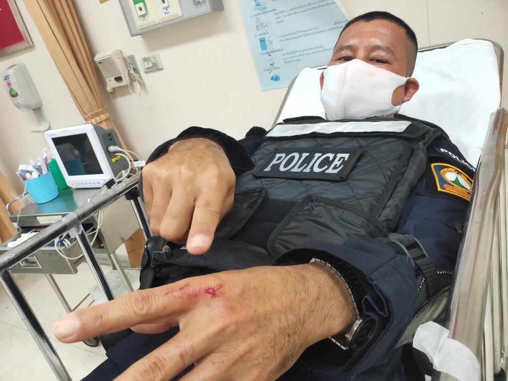 มึงๆ คฝ เจ็บแหละ

แผลใหญ่มากกก กุนึกว่ามีดบาด