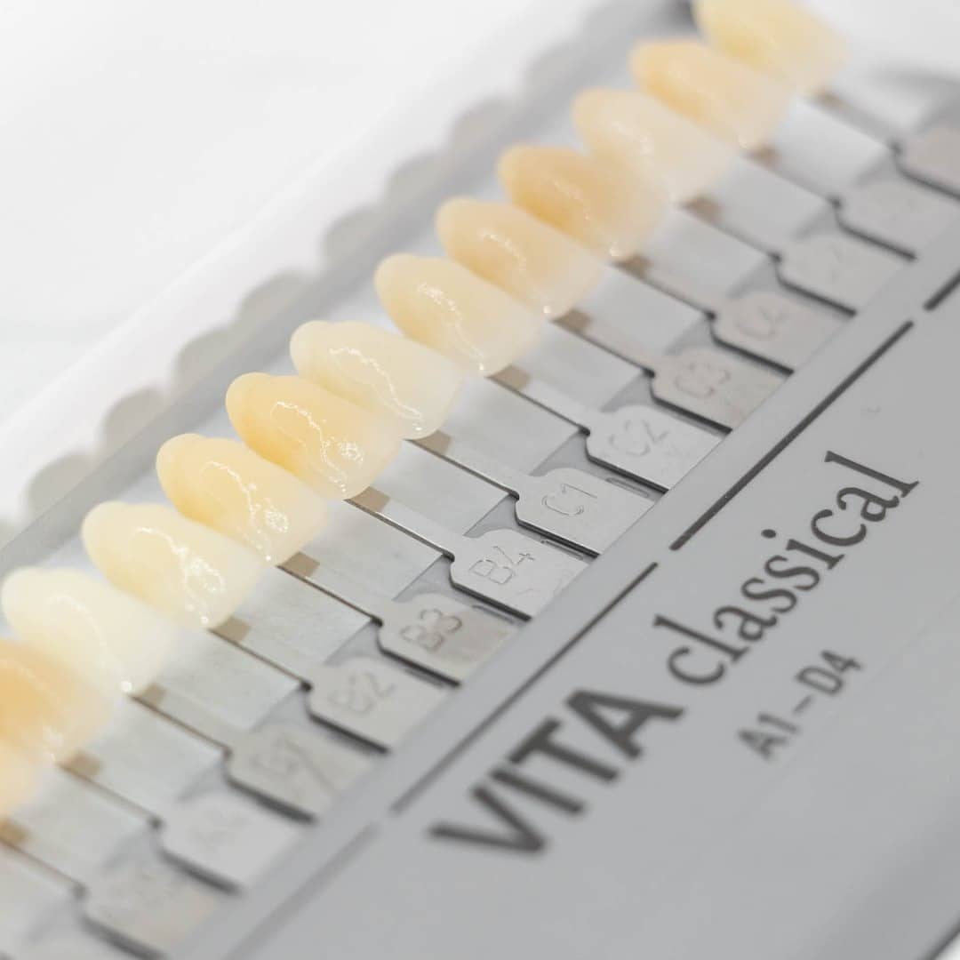 tedea07's tweet image. 🔴Guía VITA clásica original  A1 – D4 permite la determinación segura del color dental.

Clasificación:

A1 - A4 (rojizo-marronáceo)
B1 - B4 (rojizo-amarillento)
C1 - C4 (grisáceo)
D2 - D4 (rojizo-gris )
#Vita #dental #odonto #LunesDeGanarSeguidores #dental #dientes #cenatede