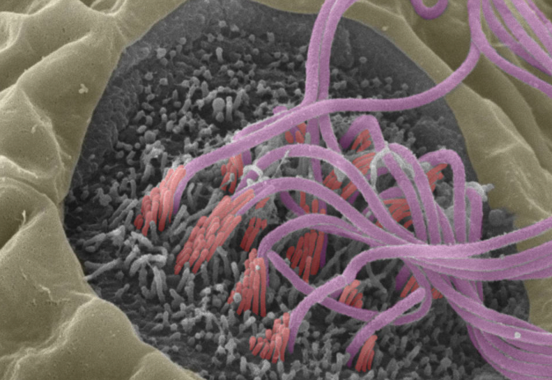 UpstateCDBio's tweet image. Graduate student Peu Santra (Amack lab) will be presenting her PhD defense seminar, “Analysis of Vacuolar-type H+-ATPase function in neuromast hair cells in zebrafish embryo” on Mon., 8/30 at 1:00 pm EST. For Zoom link, register at forms.gle/RVSSKh8TWmBKmi…