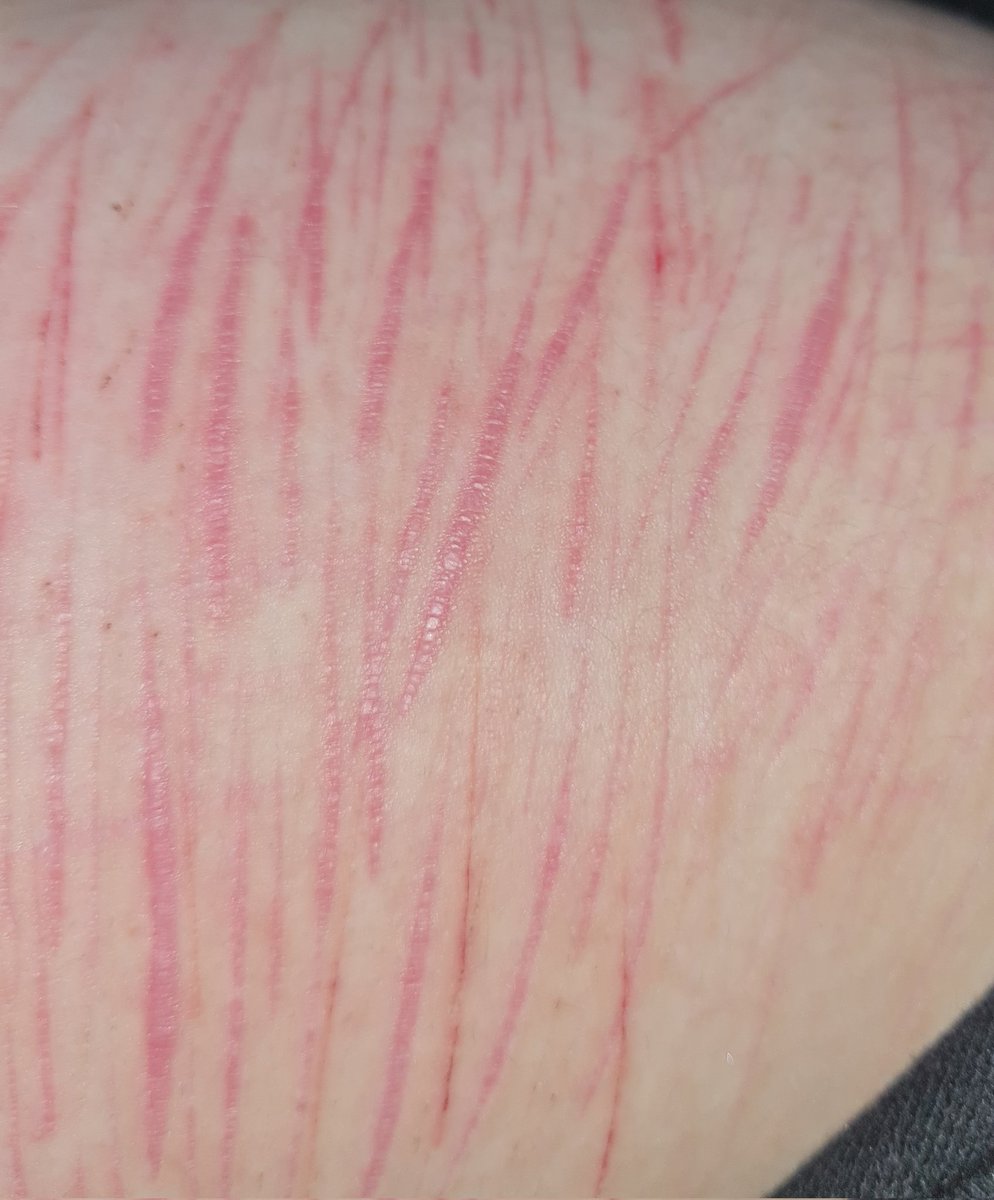 coreycantspeak2's tweet photo. tw healed self harm scars
-
-
-
-
-
-
-
-
cant be the only one who thinks they're kinda sexy 😫😫😫 /hj https://t.co/kygjDF6QY3