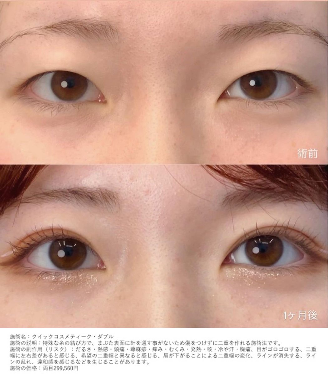 末広二重 Twitter Search Twitter