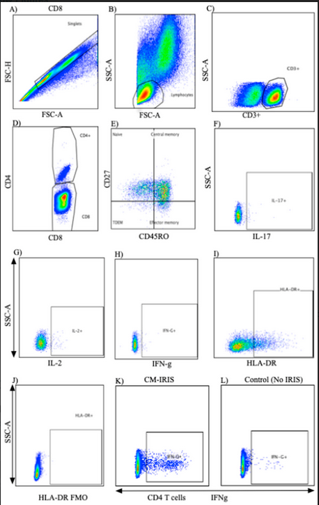 JoF_MDPI's tweet image. &quot;HIV-Associated #Cryptococcal Immune Reconstitution Inflammatory Syndrome Is #Associated with Aberrant T Cell Function and Increased #Cytokine Responses&quot; From Dr. Meya et al.

Full paper at mdpi.com/2309-608X/5/2/…