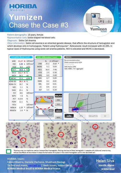 horibamedical's tweet photo. #ChaseTheCase the 3rd issue has just been published, which focuses on "Sickle Cell Anemia". In the monthly Chase the Case, you will find a selected #hematology clinical case obtained from #Yumizen H2500 analyzers. Download and subscribe at: https://t.co/4vzPiU26Lf #haematology https://t.co/USGF9xkAYO
