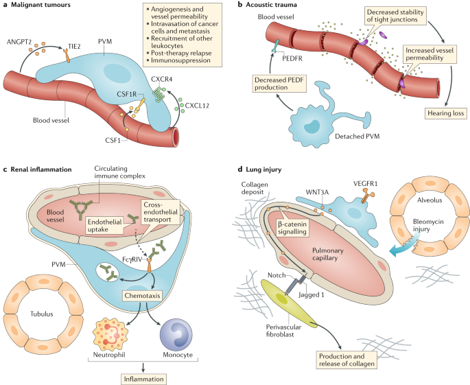 CancerNemi's tweet photo. Perivascular macrophages in health and disease

Antonio Lapenna et al.

| Nature Reviews Immunology |

10.1038/s41577-018-0056-9

#H2020 #MSCA #cancerproject https://t.co/SHZo5cZZwP