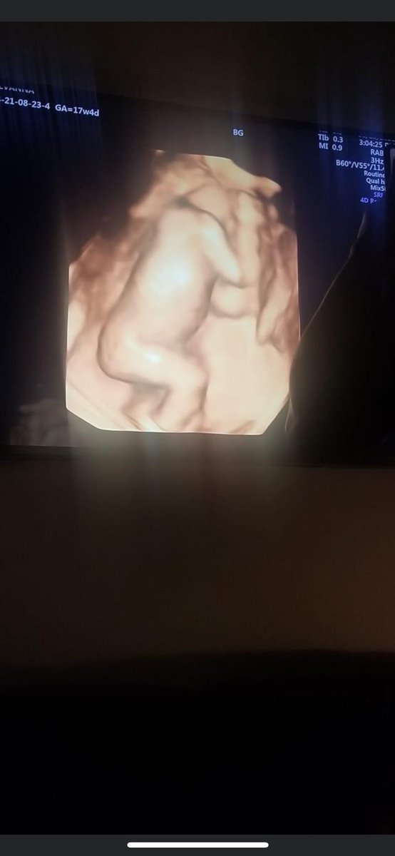 My baby GIRL, Ivory Corrine hall