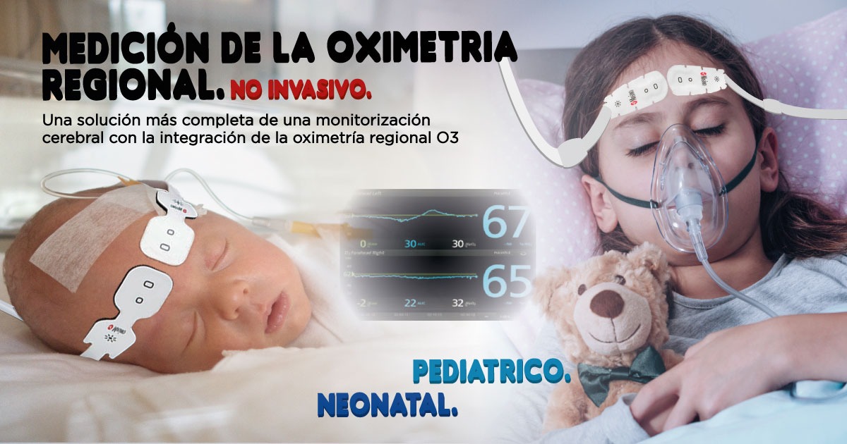MasimoTimed's tweet photo. Oximetría regional O3, mediante un sensor colocado en la frente, ayuda a los clínicos a monitorear el nivel de oxigenación del cerebro con el fin de detectar la hipoxemia cerebral en situaciones en las que la pulsioximetría sola no puede lograrlo debido a varios factores. https://t.co/zXwEmn3AEt