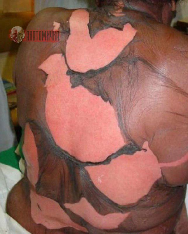 The best description ?