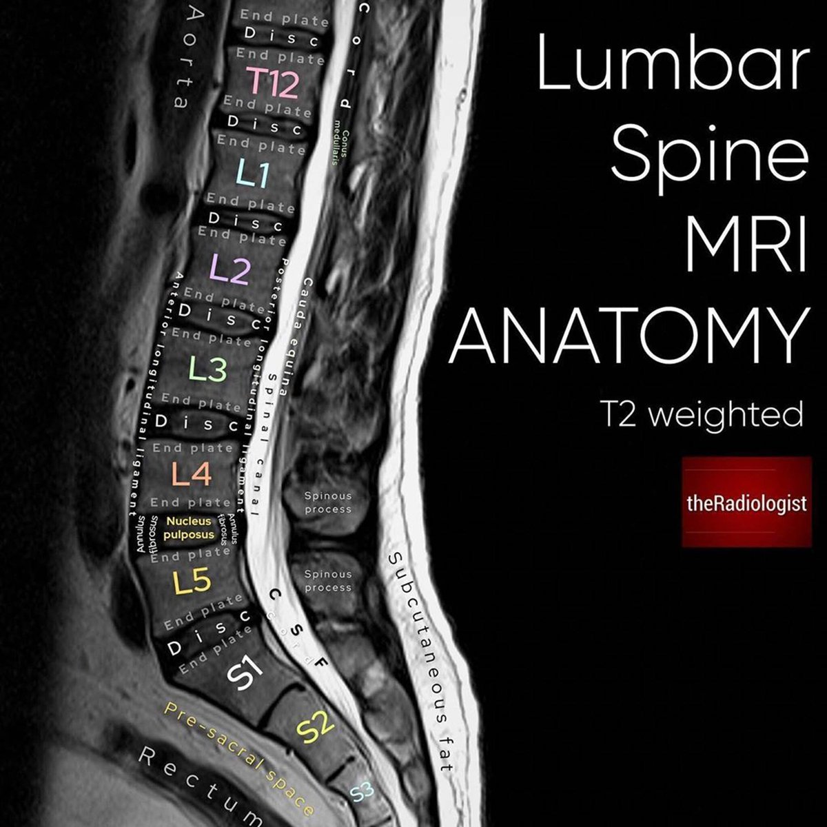Basics of lumbar MRIs: A Thread

Want to know what you’re looking at on a lumbar MRI? Read on…. 👀

We’ll look at some images &amp; try and figure out what’s ‘normal’.