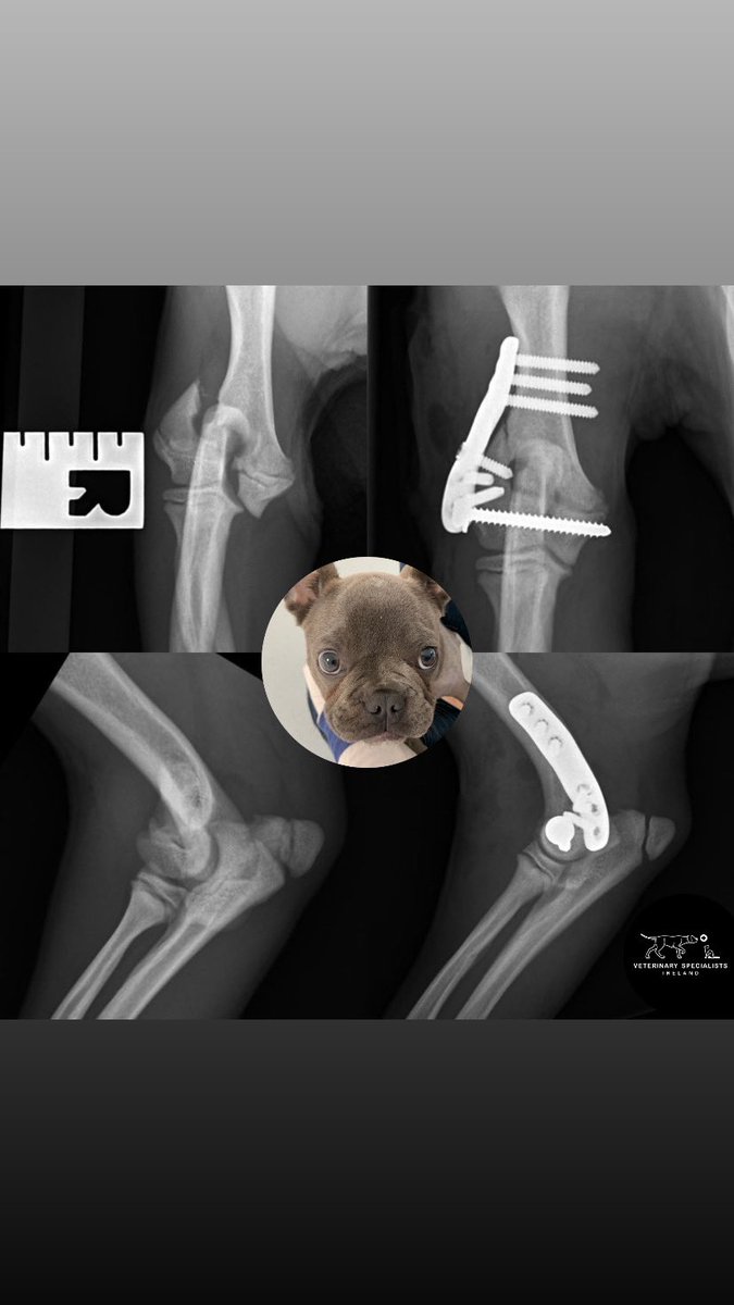 Did you know that baby Frenchies are particularly prone to elbow fractures?

Early and accurate repair is essential to restore and maintain a healthy elbow joint 💪🏻 

We use custom 3D-printed implants designed specifically for French Bulldogs to optimise repair

#mischiefmanaged
