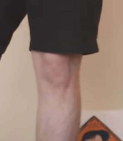 caset96's tweet photo. why is there a baby trapped in @drewisgooden's knee cap? https://t.co/9Q1F9emABo
