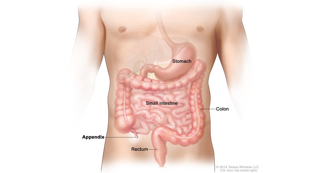 NCIDirector's tweet photo. August is Appendix Cancer Awareness Month.
#AppendixCancer is considered a #RareCancer, however recent studies show that it is becoming more common. #AugustForAppendixCancer
More info:
https://t.co/c8TiJVtsDj https://t.co/6wEaEXMazR