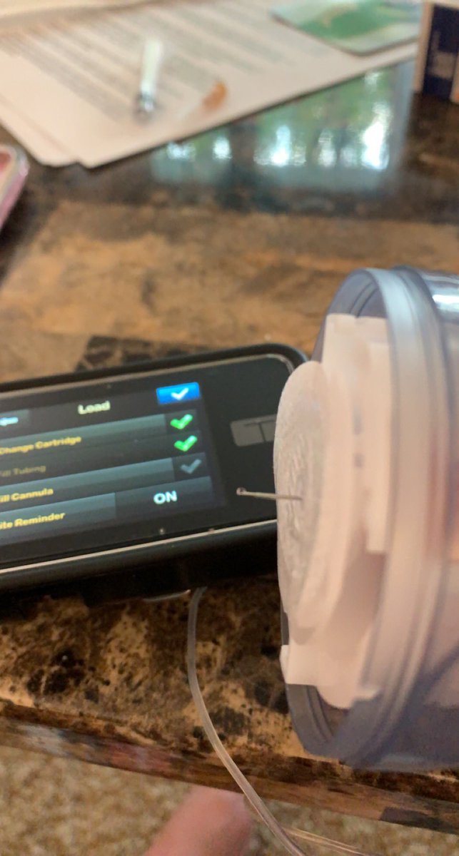 devinecasanova's tweet image. Pump change night for Trey #tandem #tslim #insulinjunkie