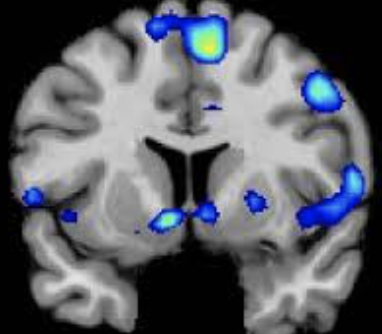 ecalixto's tweet photo. Nadie es imprescindible, pero hay muchas personas difícilmente sustituibles: esto depende de la dopamina, oxitocina y endorfina que hemos liberado en nuestro cerebro por su compañía.

#NeuroTuit https://t.co/NsjKhMCuKT