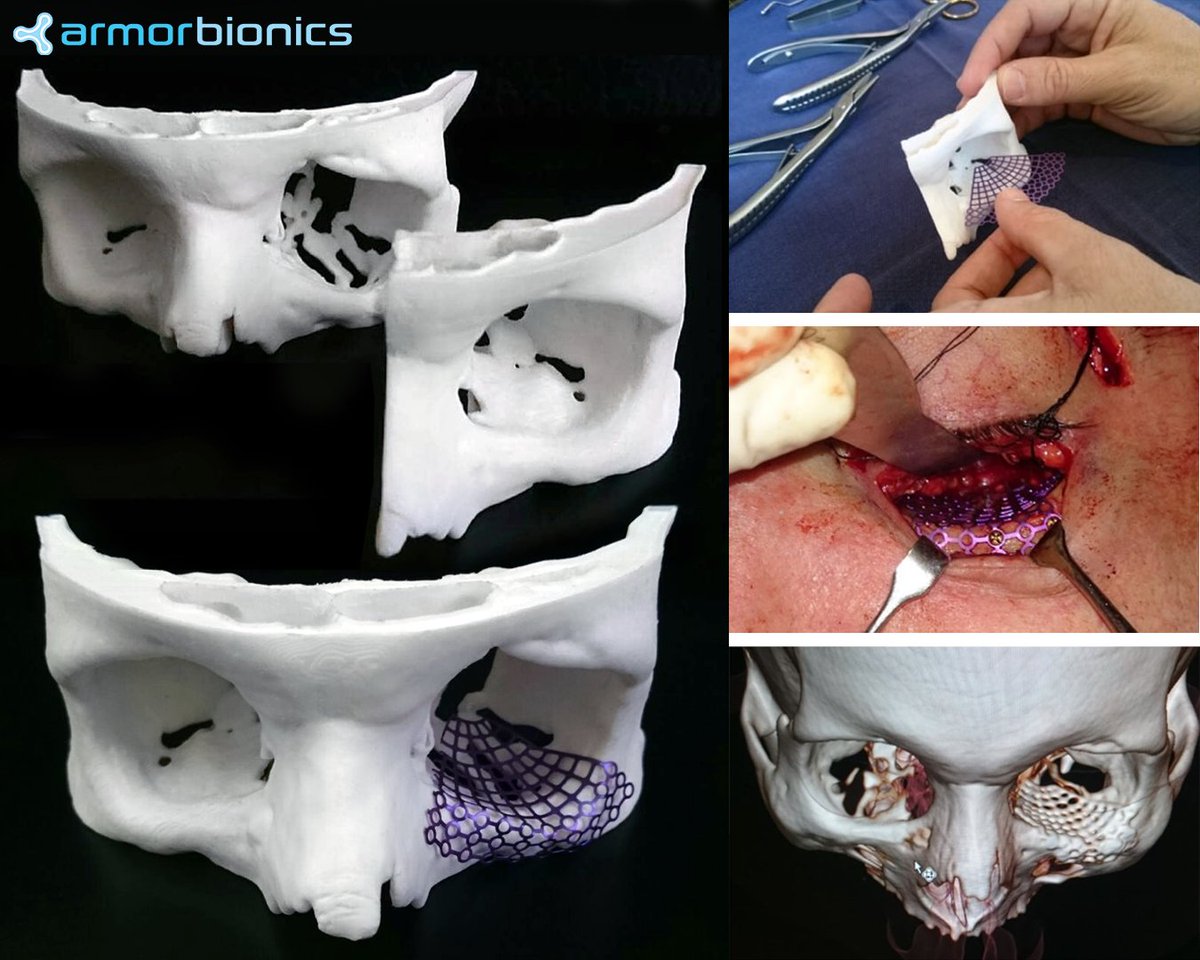 Armor Bionics tweet media