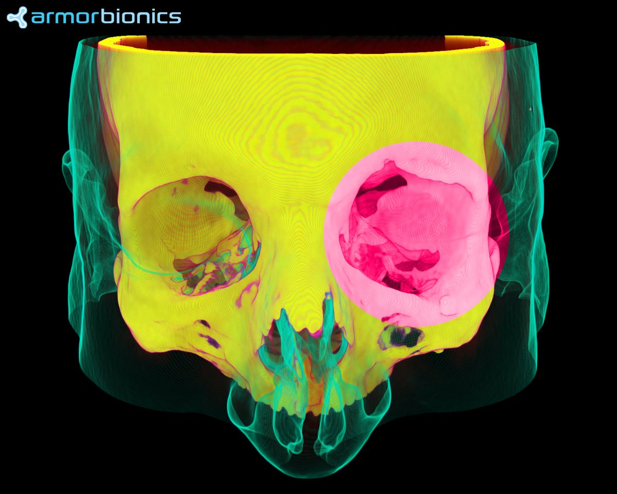 Armor Bionics tweet media