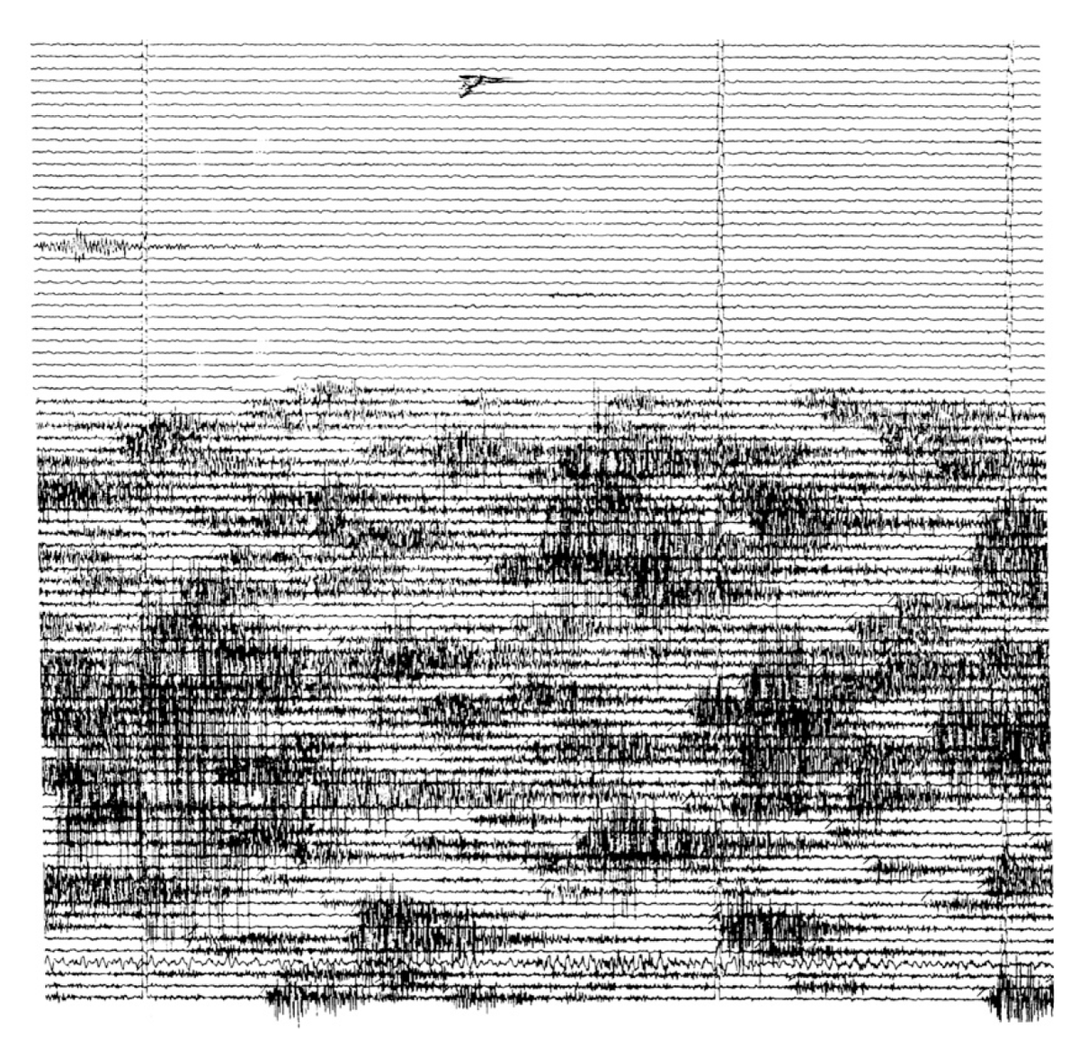 museumsound's tweet photo. Seismic reading of a 3-minute volcanic earthquake swarm at Volcán de Colima, México, November 1997. The seismogram was recorded 4 km from the crater.
#volcano #earthquake #seismogram #seismology https://t.co/1osAifusBb