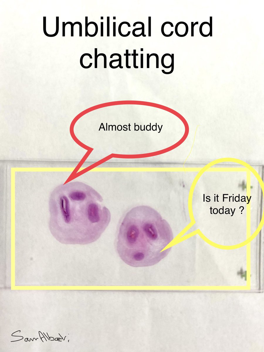 Sam Albadri, M.D., M.Sc. (@sam_albadri) on Twitter photo Signed out this placenta case with these two funny guys 😂😂 on the slides talking to me #placenta #pathologists #pathologists <a href="/HennepinPathol1/">Hennepin Healthcare Lab and Pathology</a> Signed out this placenta case with these two funny guys 😂😂 on the slides talking to me #placenta #pathologists #pathologists <a href="/HennepinPathol1/">Hennepin Healthcare Lab and Pathology</a>