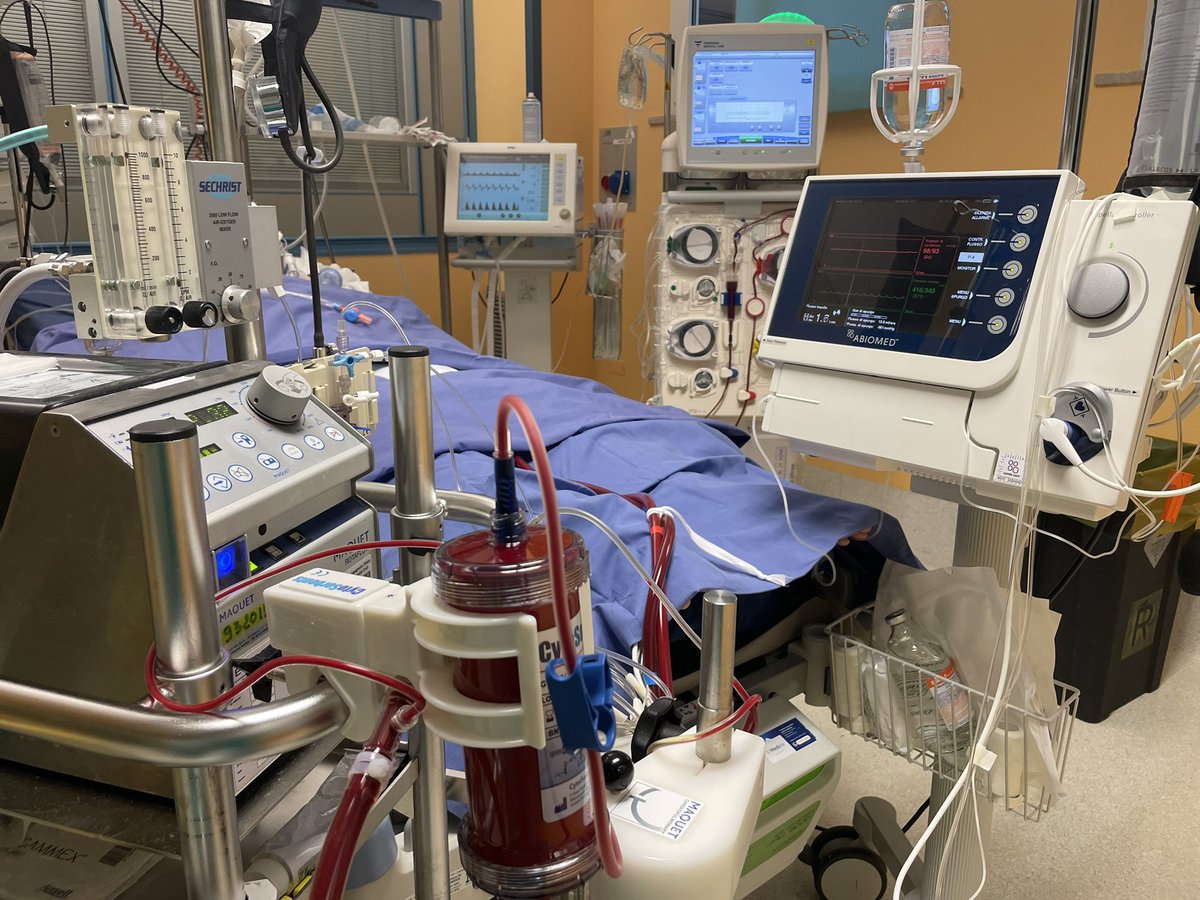 azangrillo's tweet photo. Esempio di ritorno alla normalità in terapia intensiva cardiochirurgica: Circolazione extracorporea e supporto meccanico in miocardite fulminante in giovane paziente #SARSCoV2 positiva, non vaccinata. #CurareTutti senza dare i numeri. https://t.co/kQMuGVhS06