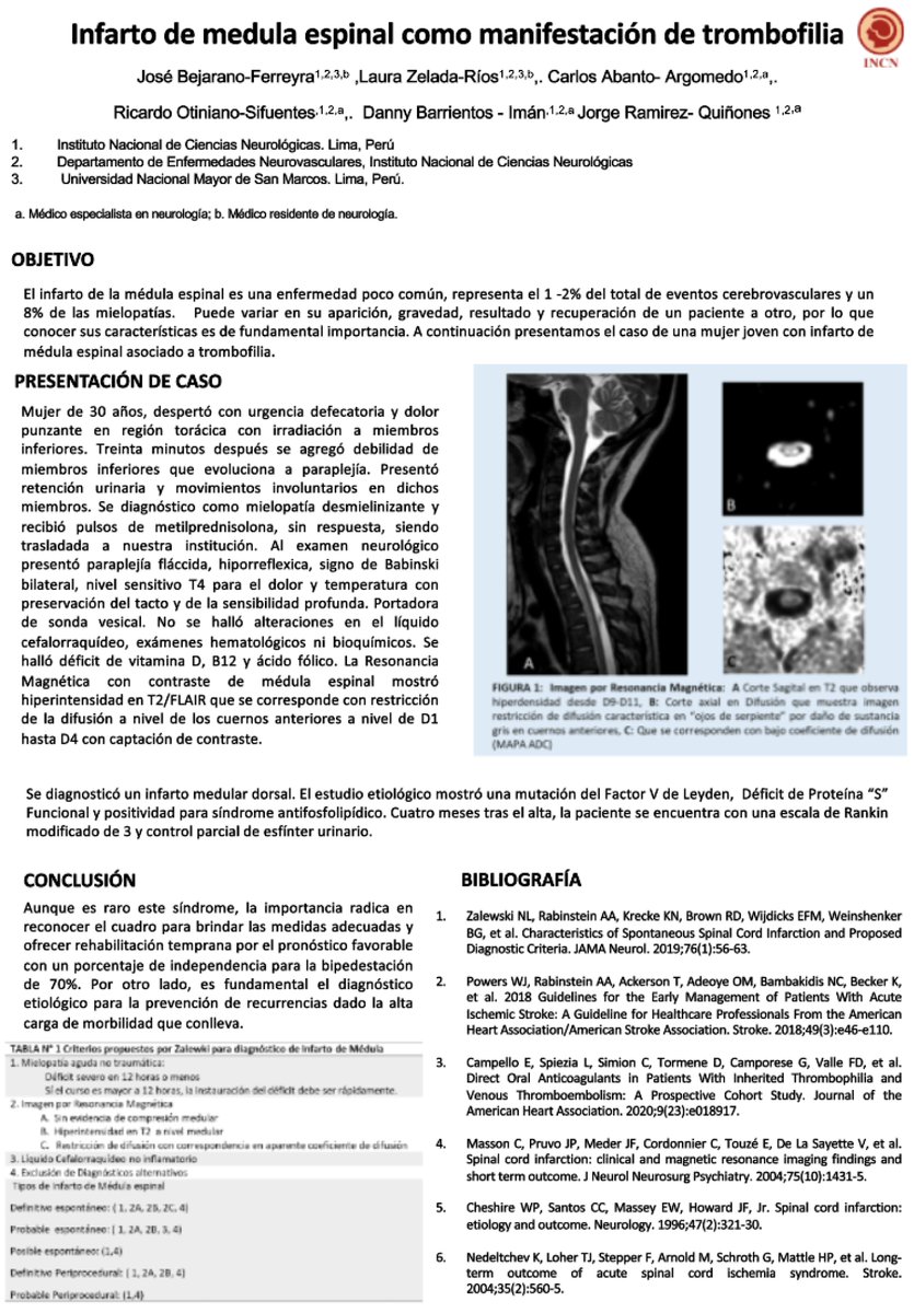 En esta oportunidad queremos que conozcas un poco más acerca del Infarto de medula espinal como manifestación de trombofilia​. 👩‍⚕️👨‍⚕️
spneurologia.org.pe
Escríbenos al correo:
sociedadperuananeurologiaspn@hotmail.com🧠👨‍⚕️👩‍⚕️
#Medicina #Neurology #Doctores #Enfermeras