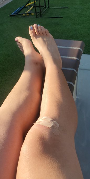 I just keep getting hurt!! ??

I'm too accident prone this month ? https://t.co/c089jOzsLm
