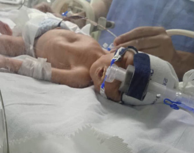 #25Ago #ServicioPúblico 
<a href="/leirisgsm/">Leiris</a>: "Urgente un #CupoUci para #Matheus Ugas, tiene 7 días de nacido él está en el Materno de Petare. Y necesita estar en cuidados intensivo neonatal. No hay cupo en Caracas! El bebé lucha por vivir. Ayuda".