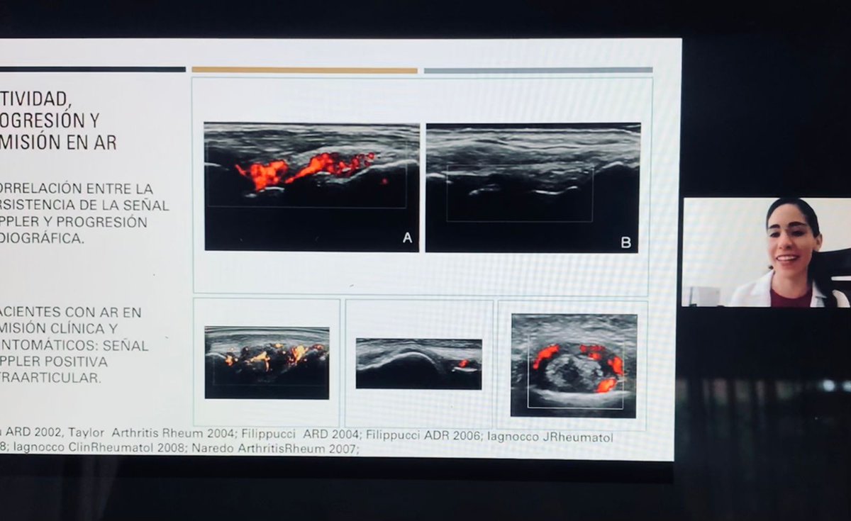 Tuvimos el honor de recibir una plática de la Dra. Ana Cecilia Lozada <a href="/AnaClozada/">Ana Cecilia Lozada 🩺</a> sobre el papel de la ecografía en artritis reumatoide. 
Agradecemos que compartiera sus conocimientos, experiencia y sobre todo su pasión por la ecografía! 
🙌🏼🙌🏼🙌🏼
#usg #reumatología #ecografía