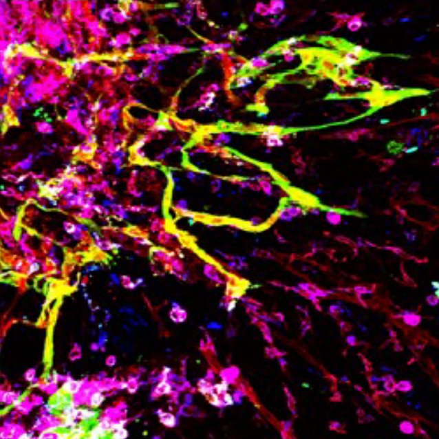 GerechtLab's tweet photo. Our lab is looking for postdocs to join our team at @DukeEngineering  - please share these opportunities!

Use of biomaterials for blood vessel growth: https://t.co/ifvXhlY2mX

Studying vascular differentiation and development: https://t.co/lfroew5FSF https://t.co/a4FS3VdzgH