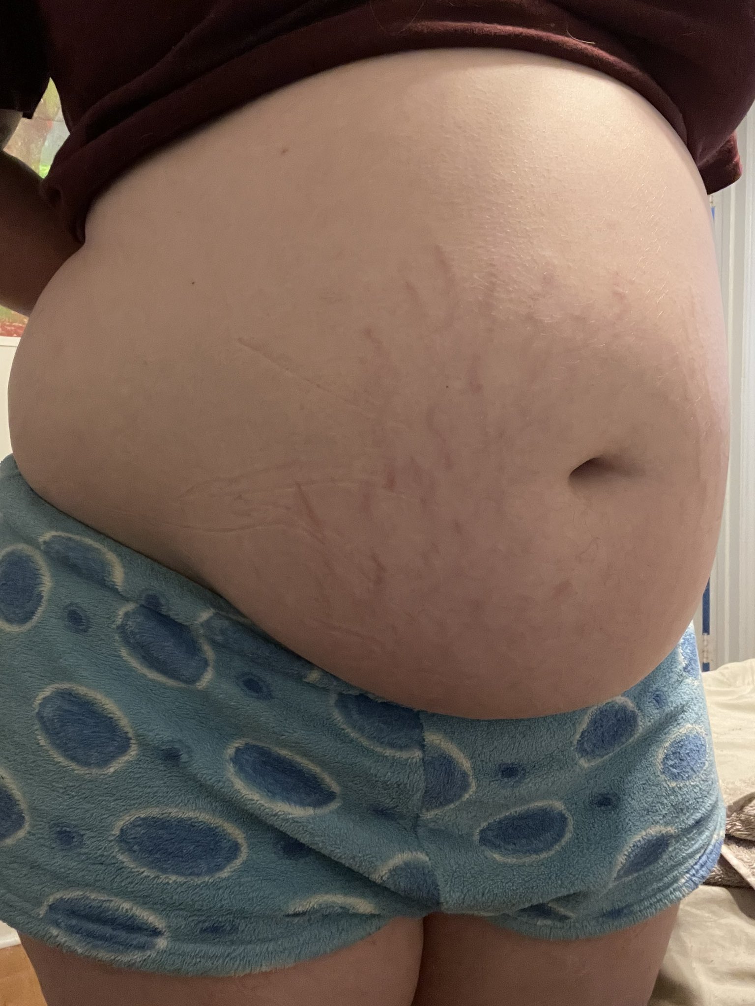 How To Get Rid Of A Food Baby