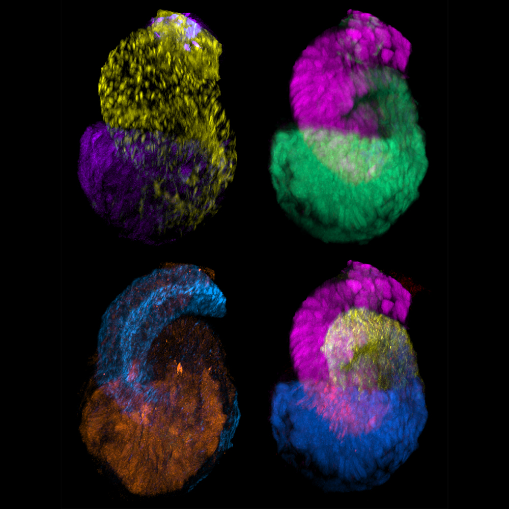 USC Stem Cell (@uscstemcell) on Twitter photo A <a href="/Dev_Cell/">Developmental Cell</a> study traces the blueprints for how human #kidneys form their filtering units. The <a href="/USCStemCell/">USC Stem Cell</a> study from Andy McMahon’s lab was led by Nils Lindström, with collaborators from <a href="/Princeton/">Princeton University</a> and <a href="/EdinburghUni/">The University of Edinburgh</a>. <a href="/LindstromLab/">Nils Lindstrom</a> <a href="/KECKSchool_USC/">Keck School of Medicine of USC</a> stemcell.keck.usc.edu/nephron-bluepr… A <a href="/Dev_Cell/">Developmental Cell</a> study traces the blueprints for how human #kidneys form their filtering units. The <a href="/USCStemCell/">USC Stem Cell</a> study from Andy McMahon’s lab was led by Nils Lindström, with collaborators from <a href="/Princeton/">Princeton University</a> and <a href="/EdinburghUni/">The University of Edinburgh</a>. <a href="/LindstromLab/">Nils Lindstrom</a> <a href="/KECKSchool_USC/">Keck School of Medicine of USC</a> stemcell.keck.usc.edu/nephron-bluepr…