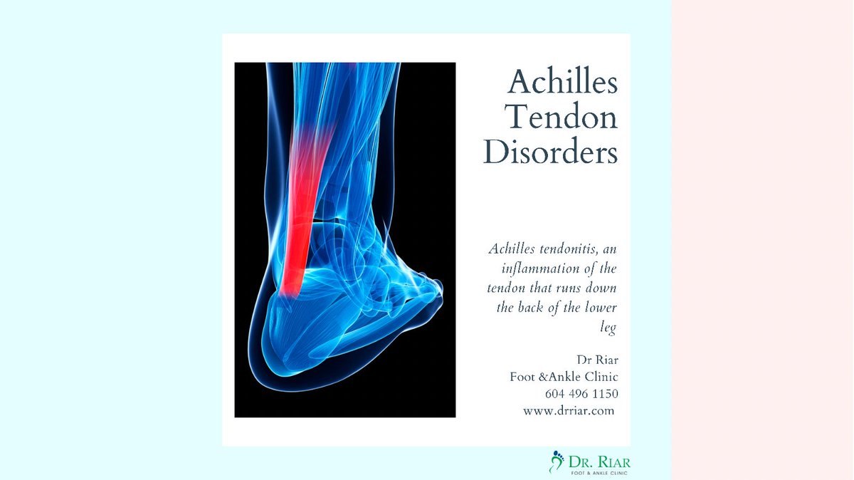 vancitydpm's tweet photo. #Achillestendonitis -inflammation of the #tendon that runs down the back of the lower #leg can progress into a degeneration of the tendon-#Achilles tendonosis A sudden increase of a repetitive activity leading to micro-injury of the tendon fibers can cause these conditions
#foot https://t.co/BEqo0ZScWJ