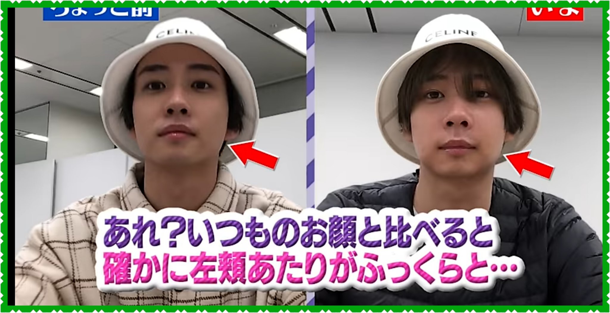 Riko Al Twitter あたし今 いつかの中村海人くんみたいに歯茎腫れて左頬がプックーっなってます 痛い マスクしてて良かったと 今日ほど思う日なかった てか 中村くん頬ふっくらしてもイケメンだな Travisjapan トラジャ 中村海人 T Co