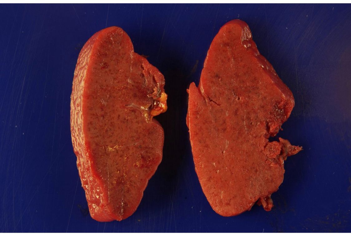 feldstej's tweet photo. #thursdayvibes #ThursdayMotivation #ThursdayThoughts #thursdaymood #thursdayviews check out https://t.co/kOS3DSlqpi #medicalstudents #pathology #residents #fellows #pathtwitter #meded https://t.co/X045ju8aNh
