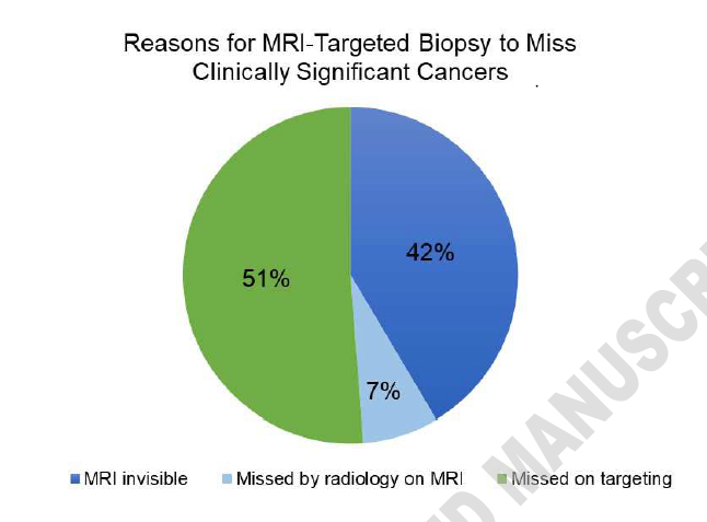 I am happy to share the 🆕 paper from our group 'Why Does MRI-Targeted Biopsy Miss Clinically Significant Cancer?' auajournals.org/doi/10.1097/JU… 'congrats @MichaelAhdootMD and our Team 👍' #prostatecancer #prostateMRI #teamscience #cancerresearch #medtwitter