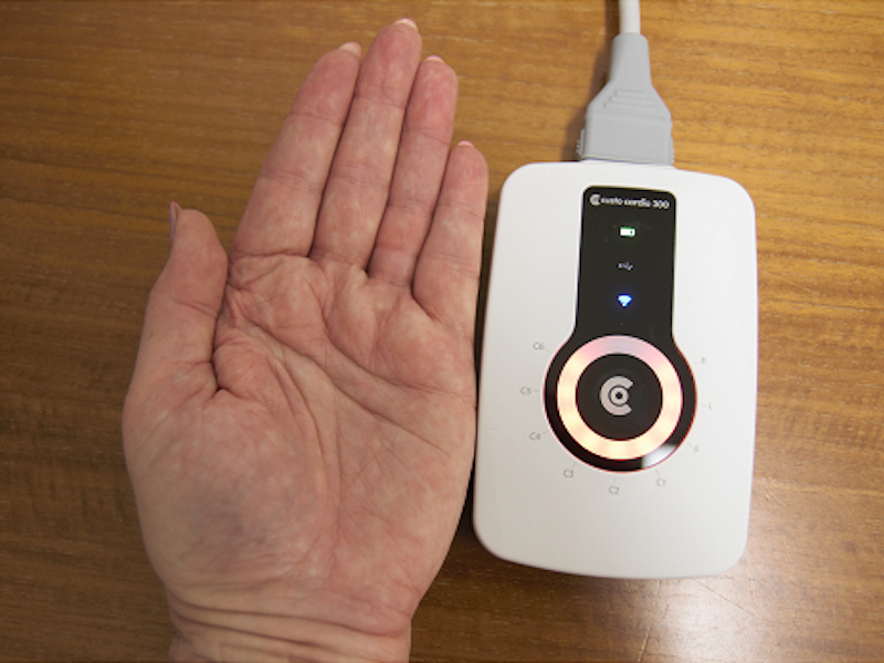 New in JMIR Cardio: User Perceptions and Experiences of a Handheld 12-Lead Electro#cardiographic Device in a Clinical Setting: Usability Evaluation dlvr.it/S6MvXV
