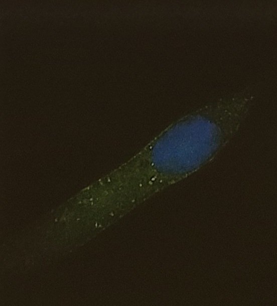 High affinity BODYPI based tracers can be used for both: PET/CT and fluorescence guided surgery. Check out the beautiful cellular images presented at the #emim! 

Ref: …mistry-europe.onlinelibrary.wiley.com/doi/10.1002/cm…