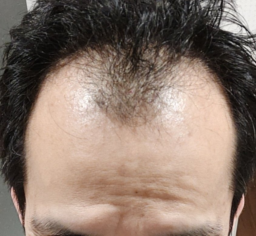 炭酸水シャンプー Twitter Search Twitter