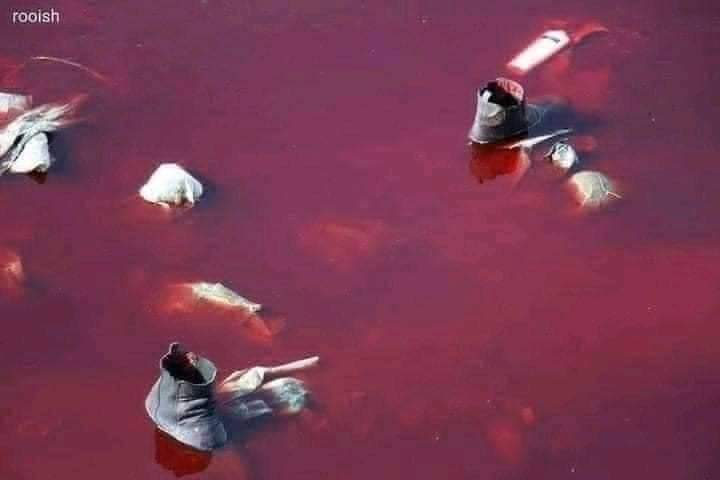 #KabulBleeds 😢 
Blood is flowing, you may have heard this
but now you can also see it,
#Afghanistan #AfghanistanBleeds
@calxandr @bbcpashto @VOAPashto @rtapashto @MunazaShaheed @ManzoorPashteen @mjdawar @NATOscr @NSCAfghan @BBCUrdu @POTUS @UN @UNGeneva
