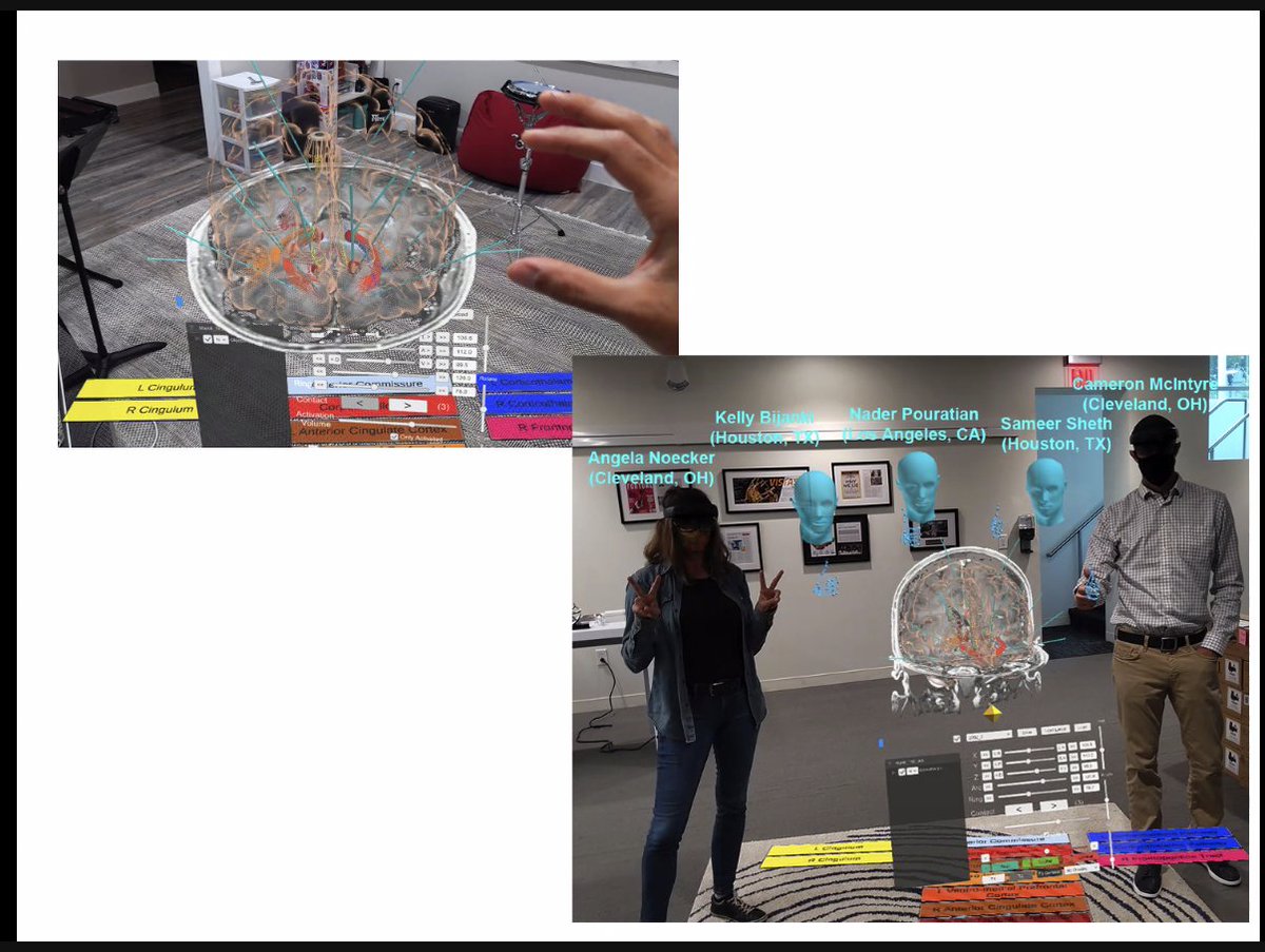 MichaelOkun's tweet photo. Plan your neurosurgery with a virtual 3-D hologram? Sign my surgeon up please. Thanks @SameerShethMD for sharing. @DBSThinkTank https://t.co/gvkAcMpOkv