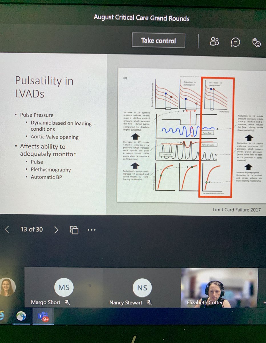 KU Anesthesia Critical Care (@ku_ccm) on Twitter photo LVAD education for ICU staff by Dr. Betsy Cotter <a href="/KUMedCenter/">KU Medical Center</a> CCGR live now! <a href="/KU_Anesthesia/">KU Anesthesiology</a> <a href="/ku_trauma/">KU Acute Care Surgery Research</a> <a href="/KUCVM/">KU Cardiovascular Medicine</a> <a href="/KUPulmCC/">KU Pulmonary/ Critical Care Fellowship</a> LVAD education for ICU staff by Dr. Betsy Cotter <a href="/KUMedCenter/">KU Medical Center</a> CCGR live now! <a href="/KU_Anesthesia/">KU Anesthesiology</a> <a href="/ku_trauma/">KU Acute Care Surgery Research</a> <a href="/KUCVM/">KU Cardiovascular Medicine</a> <a href="/KUPulmCC/">KU Pulmonary/ Critical Care Fellowship</a>