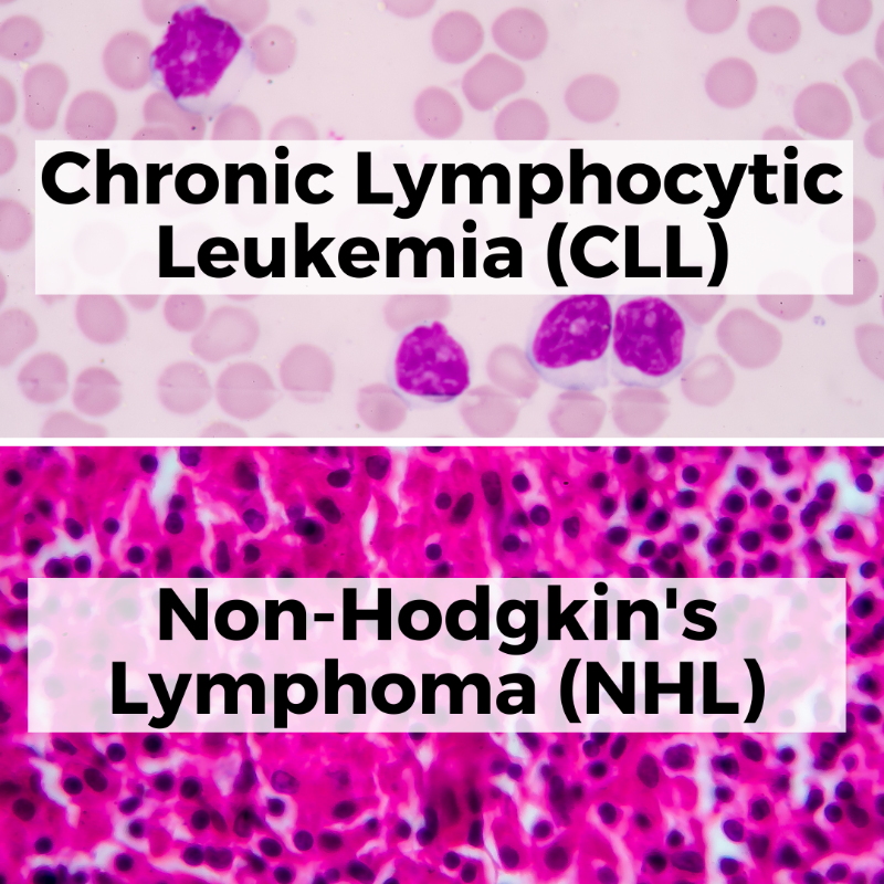 injurymatch's tweet photo. If you (or a loved one) was diagnosed with Lymphoma or Chronic Lymphocytic Leukemia (CLL) after spraying Roundup, you may be entitled to compensation.