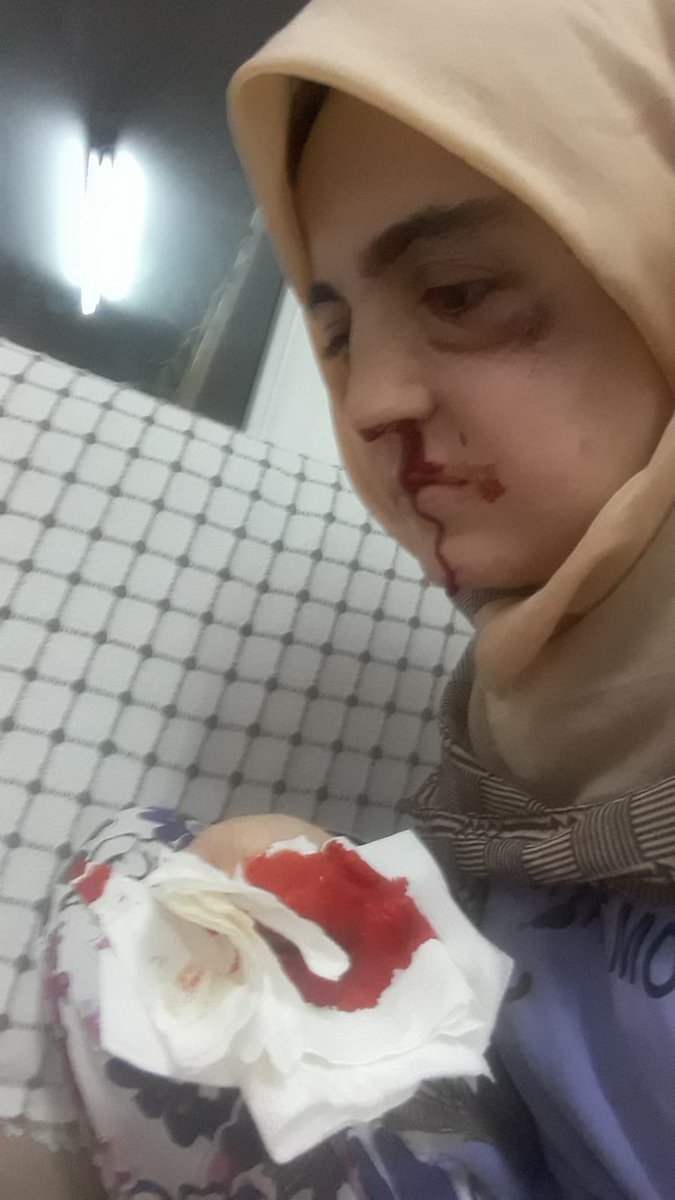 gurbette3435's tweet photo. Bu fotoğraf görüldüğünde içten edilen dualar ve beddualar kabul olsun Allahım amin 🙏 https://t.co/SpQjcCU3cW