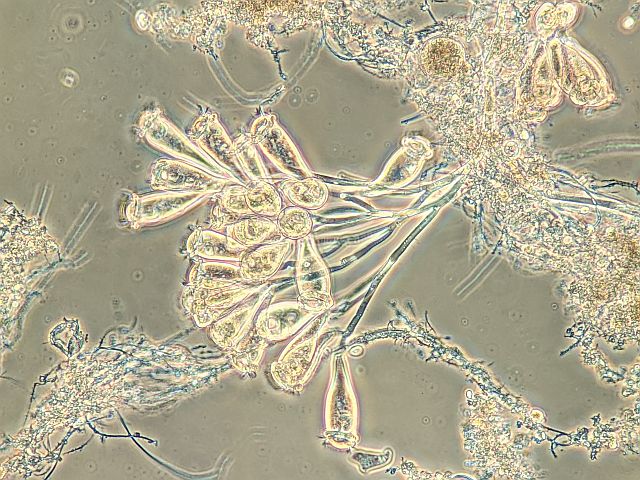 個人事業主的しがない水処理屋 エピスも素敵だが 私はカルケシウムの花束を目指す Twitter