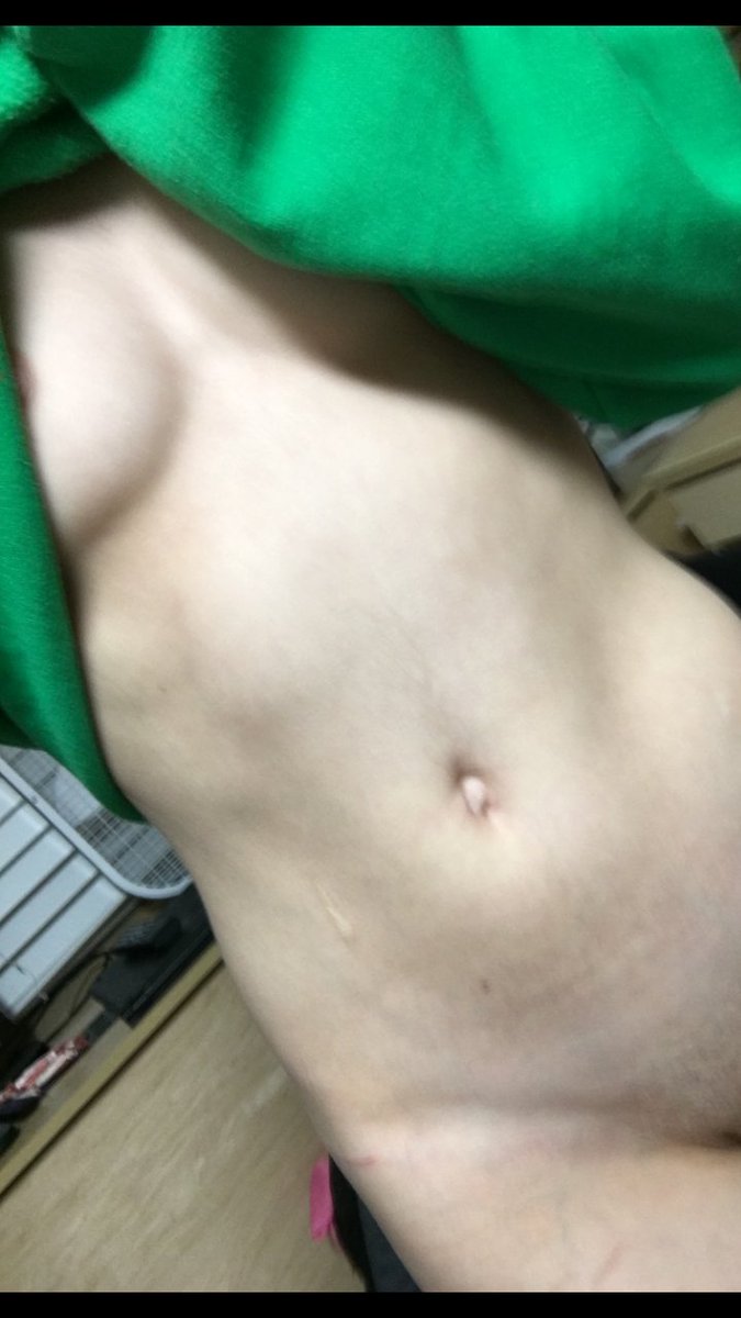 LittleBloody14's tweet photo. Screw it 🙈  every RT and  FOLLOW get a nude
#kik #Snapchat #dm #horny 
#sexting  #sext  #kik #daddy 
#topless  #whore  #cumslut  #cam #nudes #sc #dmme #fucking  #masterbait https://t.co/1OjjPE0fc0