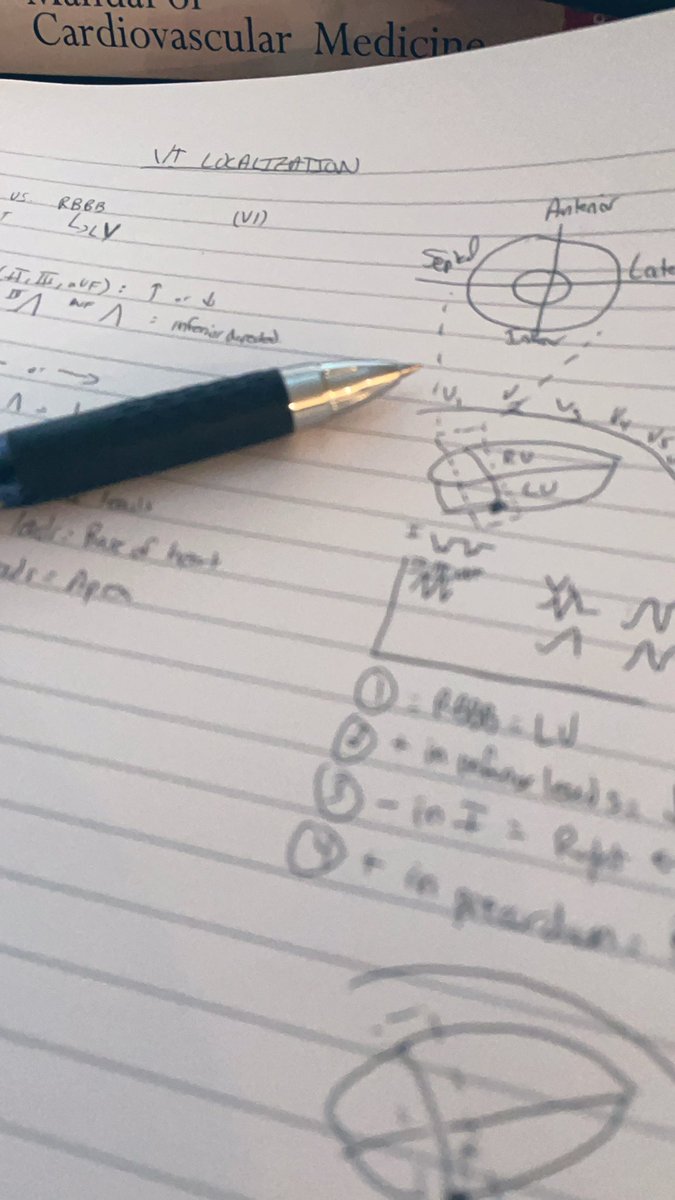 Getting back to the Med Ed roots! Trying to write out all the pearls I’m learning from EP consults <a href="/akates1/">Andy Kates</a> @wustlcardfellow #medtwitter #CardioTwitter <a href="/k_wongMD/">Kristen Wong</a> <a href="/RajaZaghlol/">Raja Zaghlol</a>