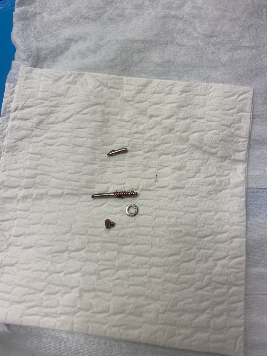 drspoon8's tweet image. How was your day??  #medtwitter #orthotwitter #hardwareremoval