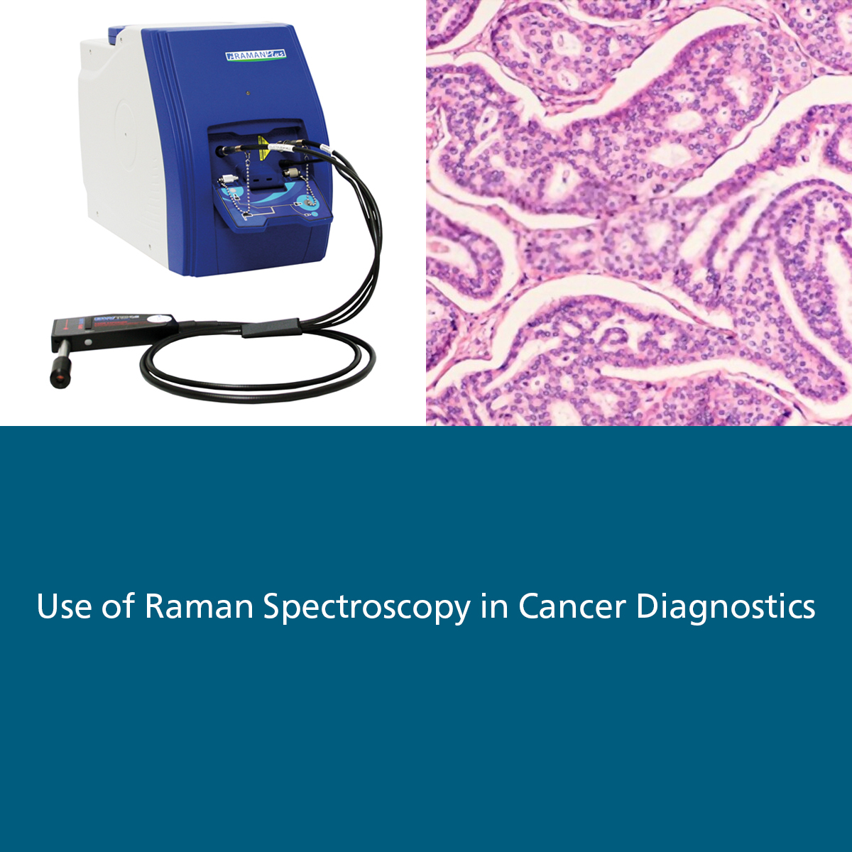 Metrohm_India's tweet photo. Raman Spectroscopy for biomedical research and clinical diagnostics. Read our application note to know more: https://t.co/cpw4Z6Bx81
#Metrohm #Biomedical #RamanSpectroscopy #Spectrsocopy #IRaman #BWTEK #ClinicalResearch #MetrohmIndia https://t.co/oZKEsbT4JY